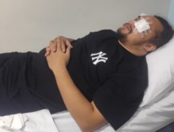 Amankan Tawuran, Anggota Polsek Bontoala, Jadi Korban Petasan